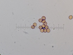 Fuligo septica candida