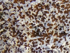 Fuligo septica candida