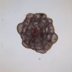 Planorbulina