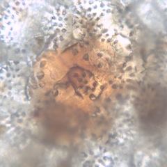 Planorbulina
