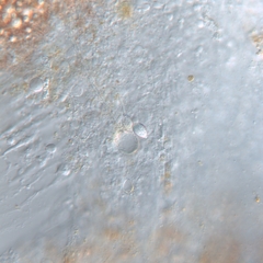 Pelagia noctiluca