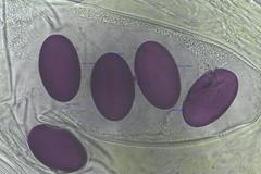 Ascobolus immersus