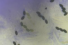 Podospora anserina