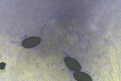 Podospora anserina