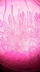 Ciborinia camelliae