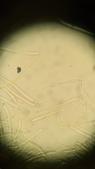 Ciborinia camelliae