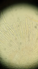 Ciborinia camelliae