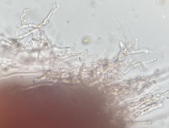 Phlebia rufa