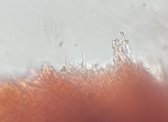Phlebia rufa