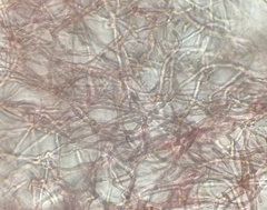Phlebia rufa