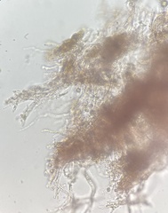 Phlebia rufa