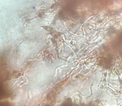 Phlebia rufa