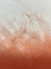 Phlebia rufa