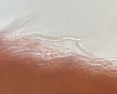 Phlebia rufa