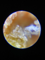 Acalitus phloeocoptes