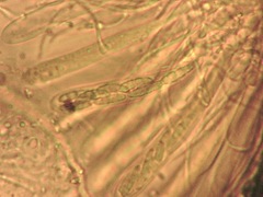 Dendrostilbella prasinula