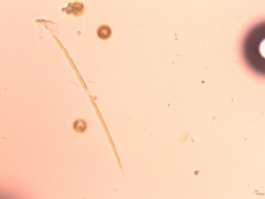 Closteriopsis