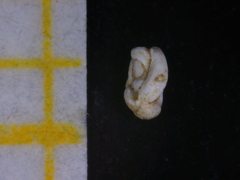 Quinqueloculina