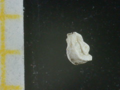 Quinqueloculina bradyana