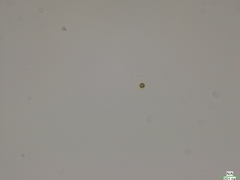 Chlorella
