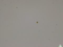 Chlorella