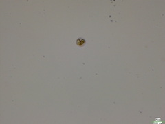 Chytridiomycota