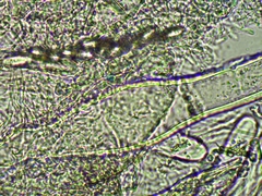 Lasiobolus macrotrichus