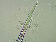 Lasiobolus macrotrichus