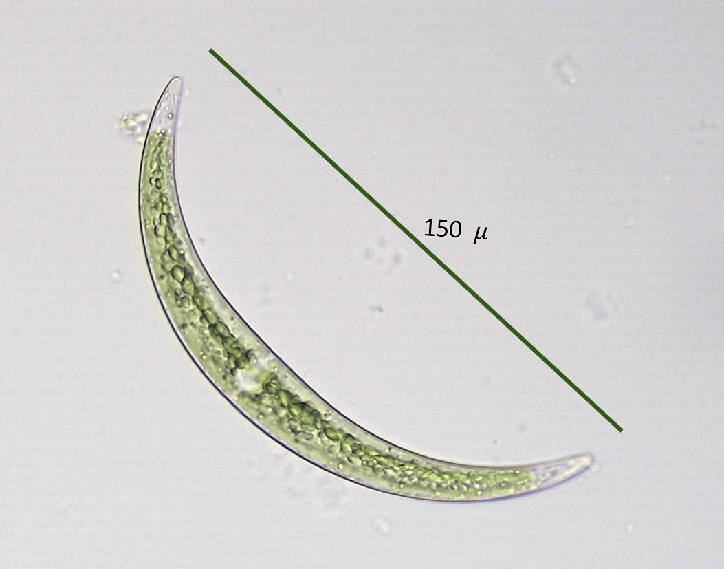 Closterium calosporum