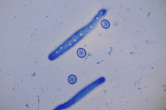 Lamprospora wrightii