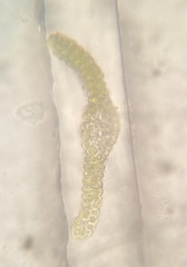Ptychomitrium incurvum