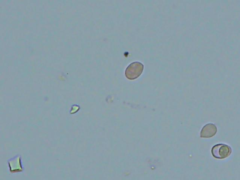 Hyphoderma