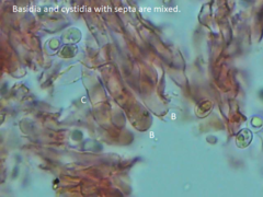 Hyphoderma