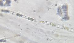 Stigeoclonium lubricum