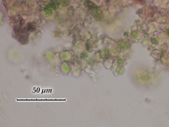 Chaenotheca phaeocephala