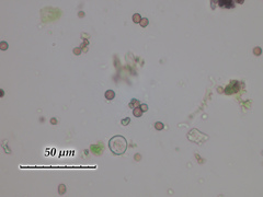 Chaenotheca phaeocephala