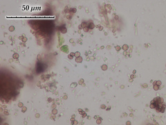 Chaenotheca phaeocephala