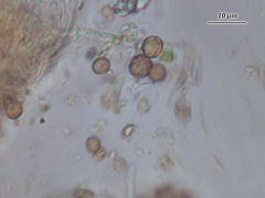 Chaenotheca phaeocephala