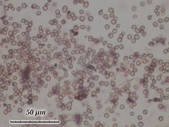 Chaenotheca olivaceorufa