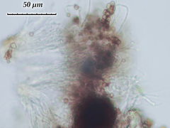 Chaenotheca olivaceorufa