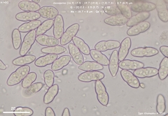 Neonectria ditissima