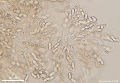 Neonectria ditissima