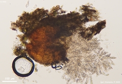 Neonectria ditissima