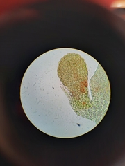 Lepidolaena clavigera