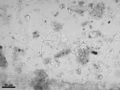 Neosemantis cladophora