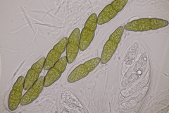 Pleomassaria carpini