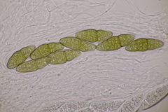 Pleomassaria carpini