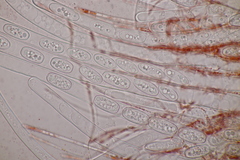Sarcoscypha austriaca