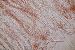 Sarcoscypha coccinea