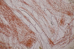 Sarcoscypha coccinea